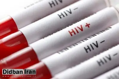 واکنش مقام وزارت بهداشت به محرمانه بودن اطلاعات تست HIV