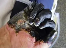 افزایش احتمال شیوع طاعون سیاه در شمال چین +جزییات 