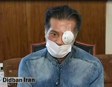 فیلم / پزشک اورژانسی که بر اثر کرونا یک چشمش را از دست داد