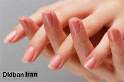 قلنج انگشتان و گردنتان را نشکنید!
