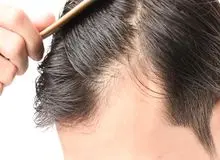 آیا کراتین باعث ریزش مو می‌شود؟