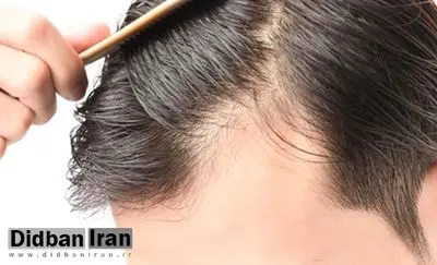 آیا کراتین باعث ریزش مو میشود؟