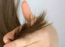 کارآمدترین ترفندها برای مقابله با موخوره