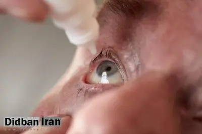 درمان پیرچشمی در یک ساعت با قطره جدید