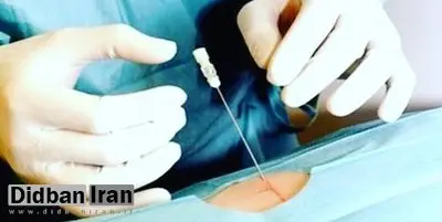 واردات دستگاه اُزنتراپی ممنوع شد
