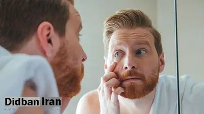 چه چیزی باعث پف صورت میشود و چگونه با ۵ روش ساده آن را کاهش دهیم؟