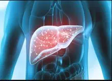 راه درمان کبد چرب مشخص شد