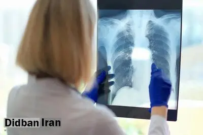 یک مشکل پنهان تنفسی ممکن است دلیل خستگی مزمن باشد