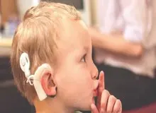 ۱۰۰۰ کودک در انتظار گرفتن شناسه کاشت حلزون/ تهیه پروتز شنوایی در انحصار ۳ شرکت خصوصی