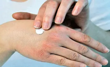 ۷ نشانه‌ پوستی که خبر از بیماری جدی می‌دهند