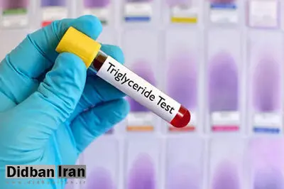 مهمترین راهکار کنترل چربی خون؛ ویژه افراد ۳۰ سال به بالا