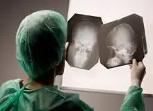 ضربه مغزی، دلیل فوت دانش‌آموز اهوازی در مدرسه

