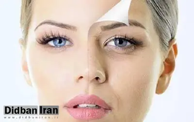 
با چهار ماده غذایی مهم برای زیبایی پوست آشنا شوید