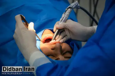چند نکته که باید درباره مواد پرکننده دندان‌ها بدانید