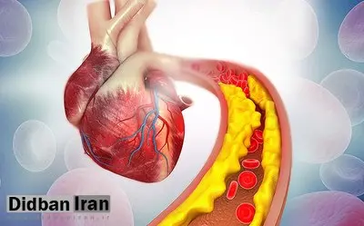 ۶ نوشیدنی برای کاهش کلسترول خون