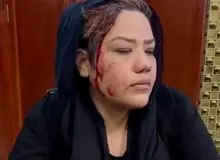 سر خونین یک زن افغان بر اثر ضرب و شتم طالبان/FILM