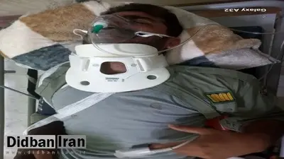 محیطبان میاندشتی مورد ضرب و جرح قرار گرفت