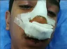 از ضرب و شتم و تهدید دانش‌آموز تا برکناری مدیر