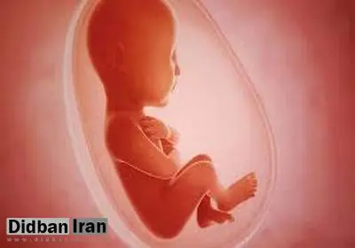ابلاغ دستورالعمل سقط جنین / سن مجاز برای صدور مجوز سقط چهار ماه قمری است