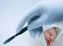 سزارین ریسک چاقی نوزاد را افزایش می دهد