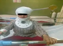 فرورفتن کفگیر در سر کودک شیرازی+ عکس
