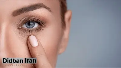 سیاهی دور چشم نشانه چه بیماری است؟/ روش‌های درمان