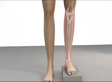 آیا حاضرید برای بلندتر شدن پاهایتان را بشکنید؟ / بررسی جراحی افزایش قد
