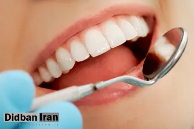 با خوردن چه غذاهایی مانع از پوسیدگی دندان ها شویم