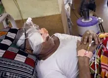 آیا قارچ سیاه می‌تواند از طریق زخم‌های پوستی وارد بدن شود؟