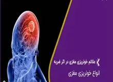 علائم خونریزی مغزی چیست؟