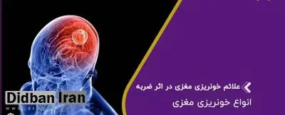 علائم خونریزی مغزی چیست؟