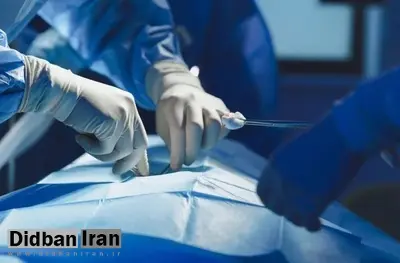 برای اولینبار در جهان، پزشکان چینی ریه خوک را به یک انسان پیوند زدند