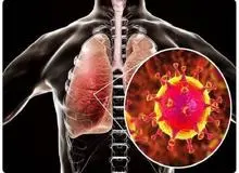 برای تقویت ریه در این روزهای کرونایی، چه خوراکی‌هایی بخوریم؟
