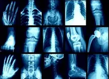 
صدور آیین نامه های غیرکارشناسی وزارت بهداشت در استفاده از تجهیزات پزشکی
