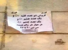 گفتگو با ۲ جوانی که چشم و کلیه‌های خود و ۲ نفر دیگر را برای فروش گذاشته‌اند؛ ۱۶۰ میلیون تومان/ عکس
