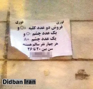گفتگو با ۲ جوانی که چشم و کلیههای خود و ۲ نفر دیگر را برای فروش گذاشتهاند؛ ۱۶۰ میلیون تومان/ عکس