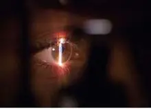 پزشکان آمریکایی تومور نخاعی را از طریق حدقه‌ چشم بیمار خارج کردند