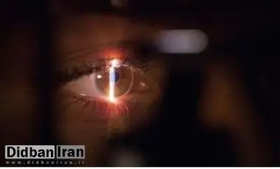 پزشکان آمریکایی تومور نخاعی را از طریق حدقه چشم بیمار خارج کردند
