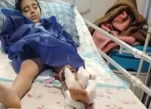 ناظم برای پاشیدن چندقطره آب روز لباسش ران و لگن دانش آموز را شکست