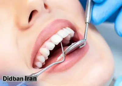 نوبت جرم‌گیری دندان‌ها را فراموش کردید؟ خطرات پنهان جدی‌تر از چیزی هستند که فکرش را می‌کنید