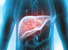 چند راهکار مهم برای درمان کبد چرب 