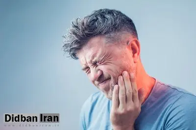 یک راه حل کاربردی برای درمان کیست دندان +عکس