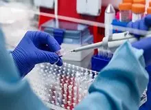 طغیان دوباره کرونا در  ۵ استان/ خوزستان، اردبیل، مازندران، خراسان شمالی و بوشهر در وضعیت قرمز
