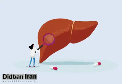دلیل کبد چرب کشف شد