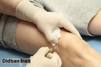 آبله میمون در رادار سازمان جهانی بهداشت؛ ۳۰ مورد مشکوک در اسپانیا و پرتغال شناسایی شد