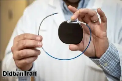 فناوری شارژ کوتاهمدت باتریهای ایمپلنتها بدون جراحی