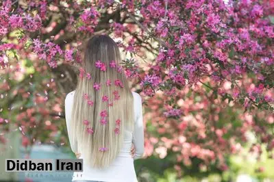 ۵ راهکار برای جلوگیری از ریزش مو
