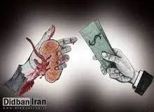 مظنه یک کلیه ۲۰۰ تا ۲۵۰ میلیون تومان/ میزان فروش کلیه برای حل مشکلات اقتصادی افزایش یافته است