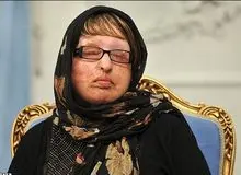 آمنه بهرامی، قربانی اسیدپاشی: پشیمانم که بخشیدم!/ دیه‌ام هنوز پرداخت نشده است