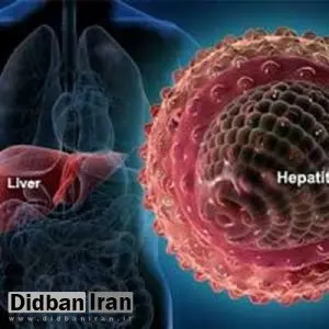 هپاتیت A با سرماخوردگی اشتباه گرفته می شود!